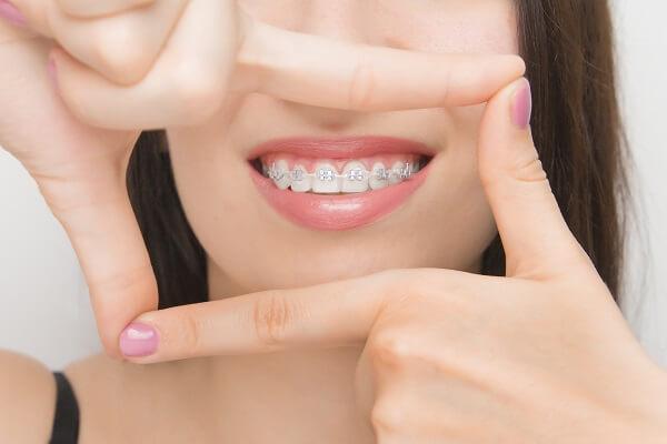 Orthodontics